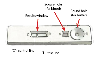 Malaria rapid diagnostic test cassette